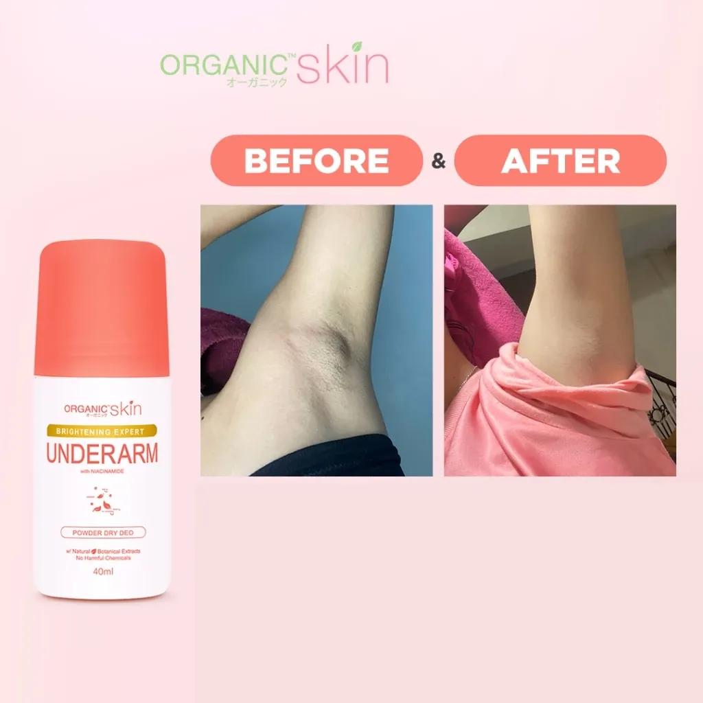 Organic-Skin-Brightening-Expert-Underarm-4.webp