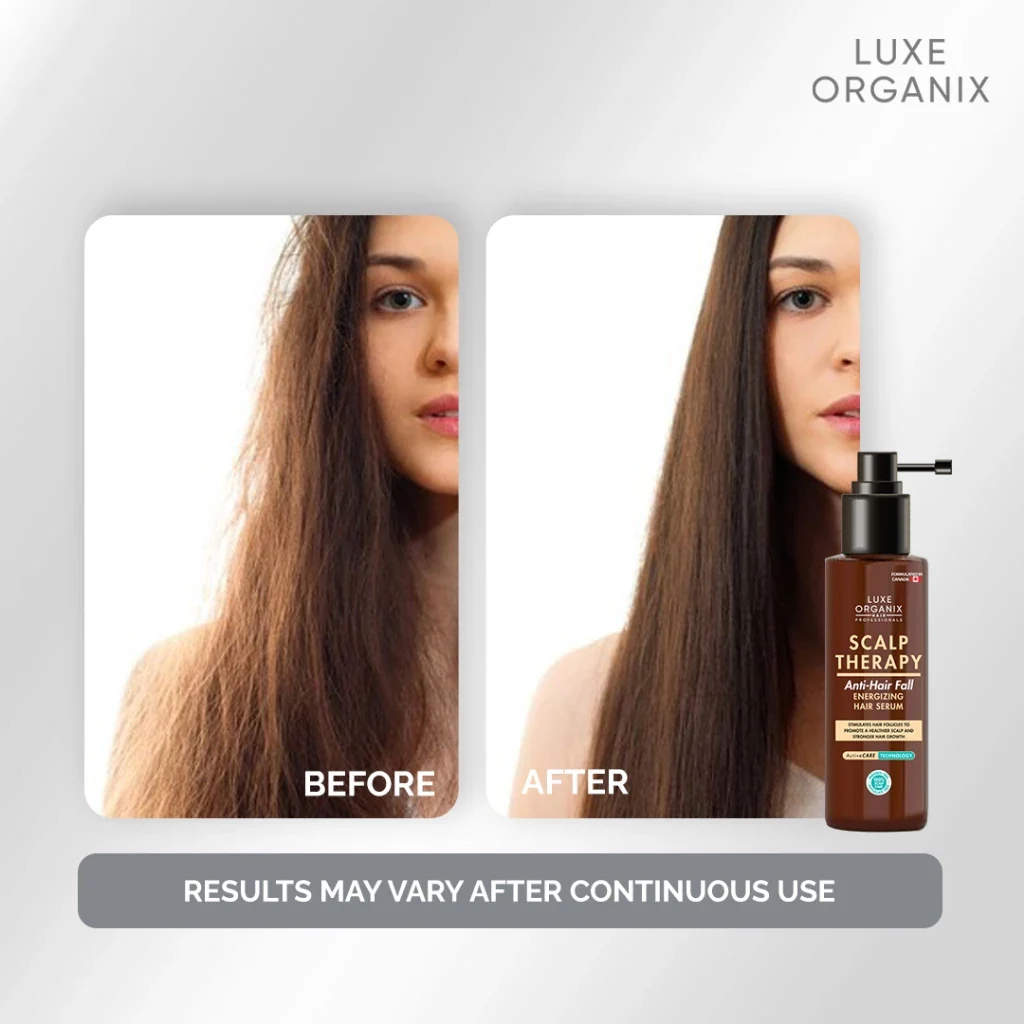 luxeorganix-scalp-therapy-anti-hair-fall-hair-serum-binibeauty-2.webp